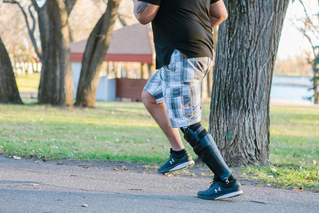 Lethbridge commercial photographer Kinsey Holt Photography for Lethbridge Orthotics and Prosthetics commercial shoot