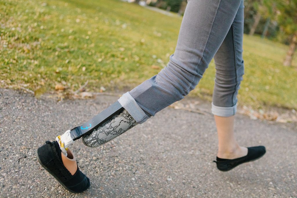 Lethbridge commercial photographer Kinsey Holt Photography for Lethbridge Orthotics and Prosthetics commercial shoot